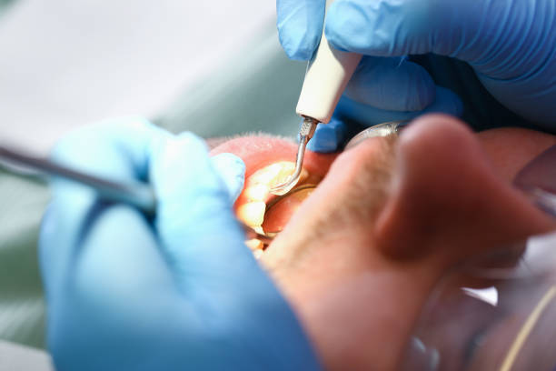 Best Emergency Cosmetic Dentistry in Bridgewater, VA